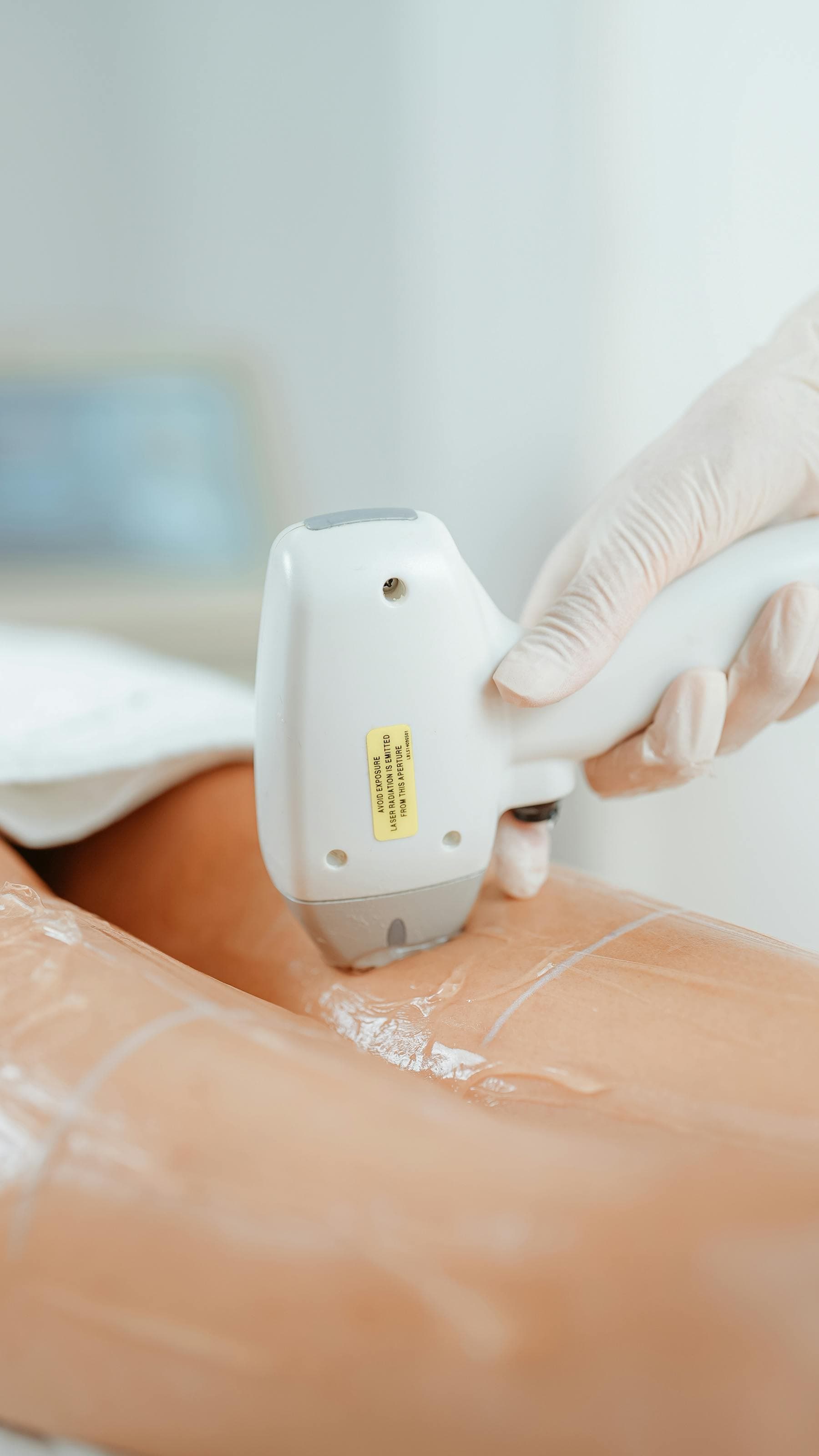 Nahaufnahme eines professionellen Laser-Handstücks während einer Behandlung — Hand in Schutzhandschuh, sichtbarer Sicherheitsaufkleber am Gerät.